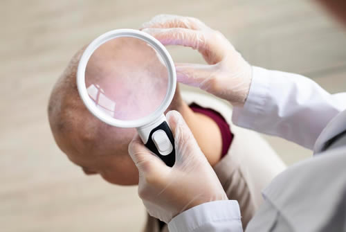 Skin Cancer Risk Factors: Who Should See a Dermatologist for a Screening?