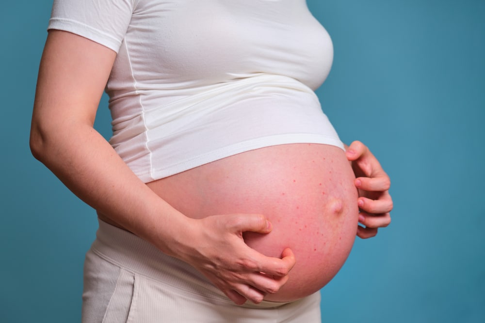 pimples-on-the-belly-of-a-pregnant-woman-studio-shot-bakersfield