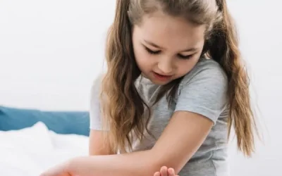 Understanding Warts in Children