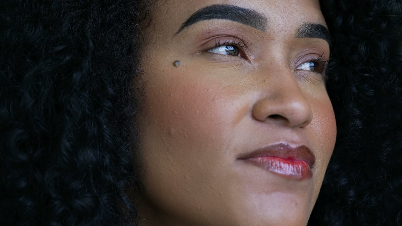 Close-up of a woman's cheek with a small raised dark spot